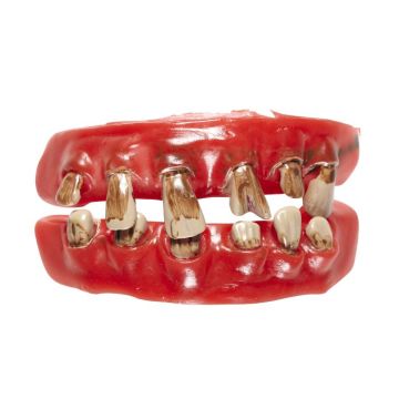 Gebis med rådne tænder